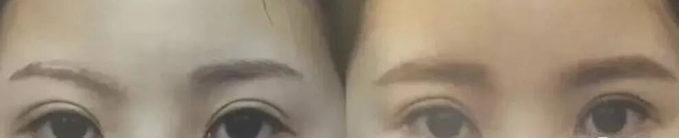 【整容】四千年美女鞠婧祎疑似连头皮都整了？！网友吐槽：是个狠人（组图） - 52