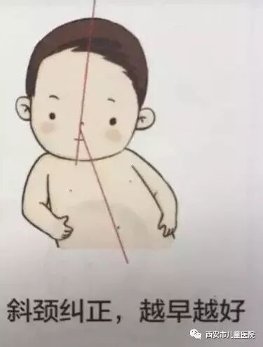 歪着脖子敲可爱但是先确定不是斜颈