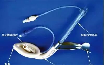 为什么要用喉罩急危重症必备：如何正确使用喉罩？_https://www.jmylbn.com_新闻资讯_第8张