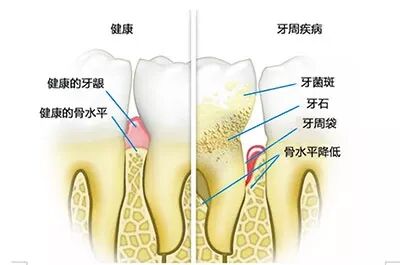口腔健康测试，如果九题全中，请自觉去看牙！