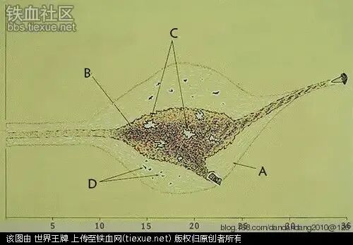 美国 5.56 毫米 M193 弹的典型伤道剖面图