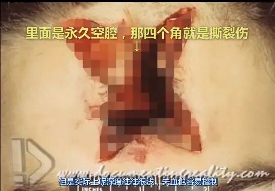 射出口示意图
