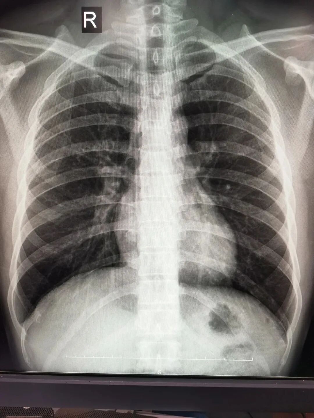x光和dr有什么区别X光、CT、MRI医学影像检查的区别有哪些？让我来告诉你。_https://www.jmylbn.com_新闻资讯_第2张