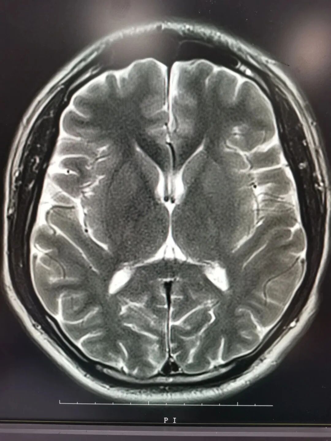x光和dr有什么区别X光、CT、MRI医学影像检查的区别有哪些？让我来告诉你。_https://www.jmylbn.com_新闻资讯_第6张
