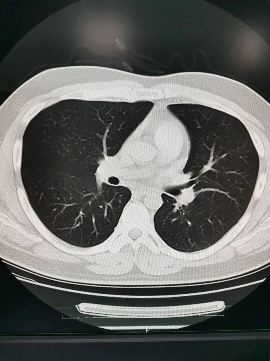 x光和dr有什么区别X光、CT、MRI医学影像检查的区别有哪些？让我来告诉你。_https://www.jmylbn.com_新闻资讯_第4张