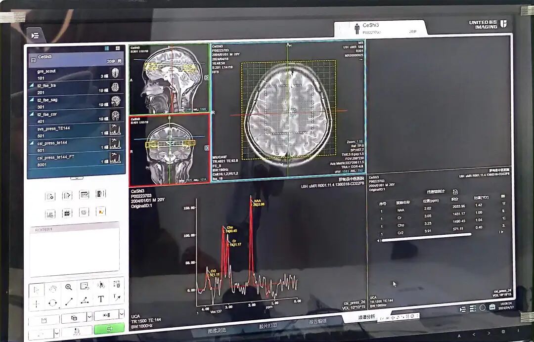 mrs高级功能成像头颅mr77dwi高清dti三维重建mrcp成像磁共振关节