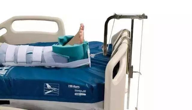 早读| 骨科牵引术的常用方式及要点