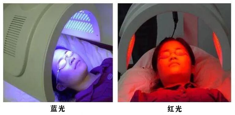红蓝光治疗仪怎么使用皮肤科神器，痘痘杀手，神奇的“红蓝光”治疗仪_https://www.jmylbn.com_新闻资讯_第2张