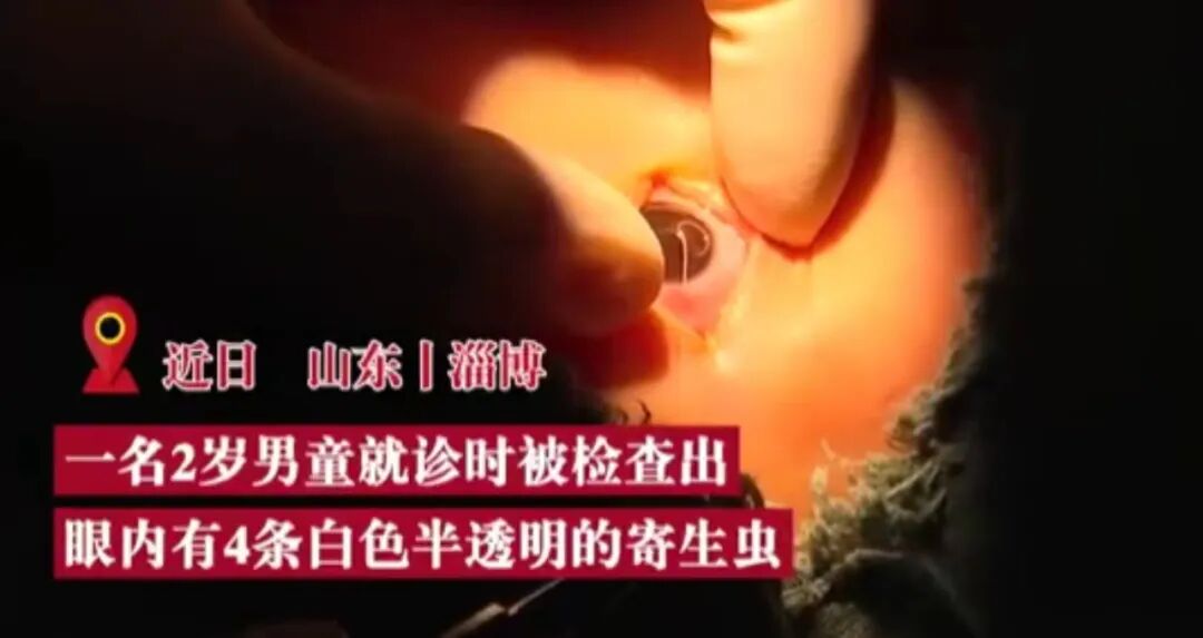 什么是无创缝合一周热点 ｜ 郑州市民在普通门诊看病可用医保报销／“一根线”缝合子宫成功保胎／三甲医院无创DNA筛查乱象／女学生用贴纸遮代孕广告_https://www.jmylbn.com_新闻资讯_第18张