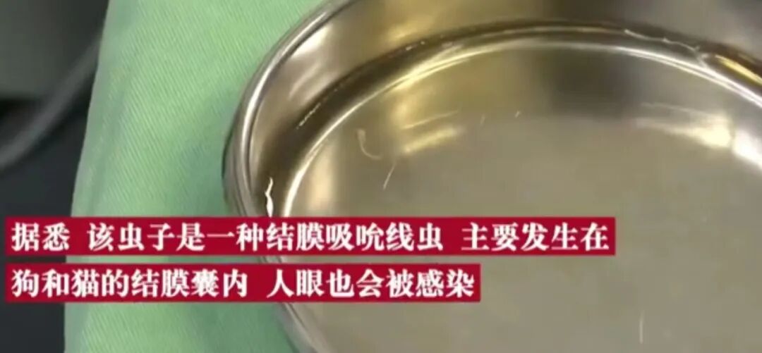 什么是无创缝合一周热点 ｜ 郑州市民在普通门诊看病可用医保报销／“一根线”缝合子宫成功保胎／三甲医院无创DNA筛查乱象／女学生用贴纸遮代孕广告_https://www.jmylbn.com_新闻资讯_第19张