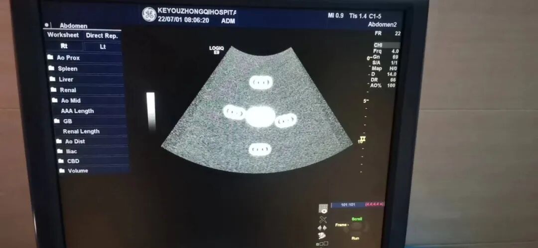 彩超怎么判断故障【微课堂】超声硬件故障｜轨迹球故障的维修_https://www.jmylbn.com_新闻资讯_第29张