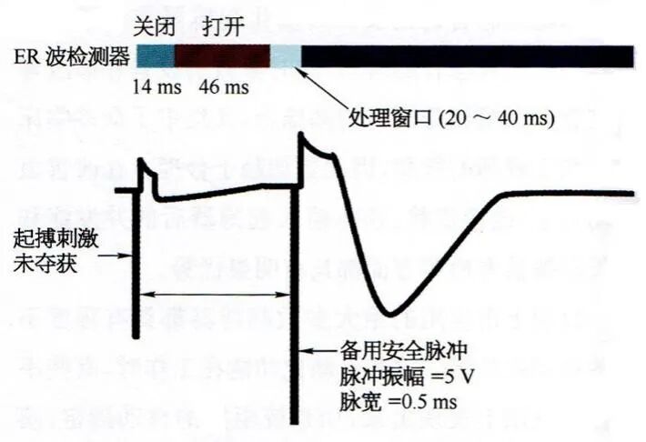 心电图会自动显示什么有趣的起搏心电图现象 ｜ 心室阈值自动测试和调整功能-上海聚慕医疗器械有限公司