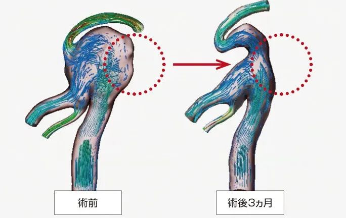 案例分析 | 从工程学角度预测血管和气管的流量并研究生物的图5