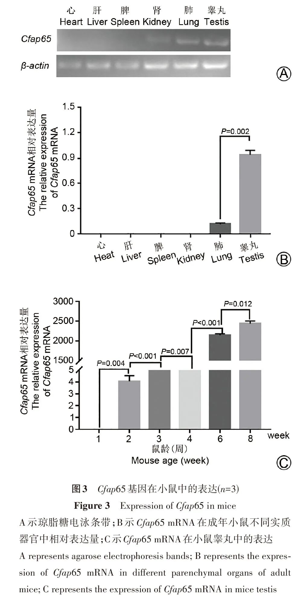 【实验研究】cfap65基因敲除对小鼠精子发生的影响
