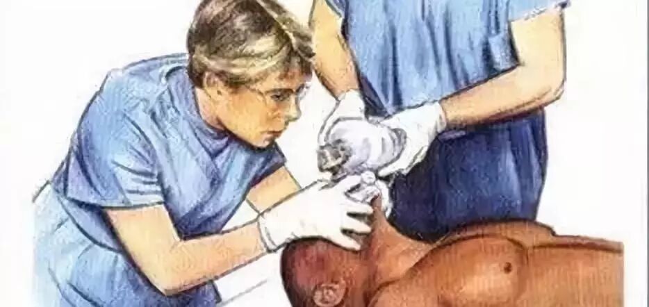 呼吸机呼气阀是什么简易呼吸器使用详解及注意事项_https://www.jmylbn.com_新闻资讯_第2张