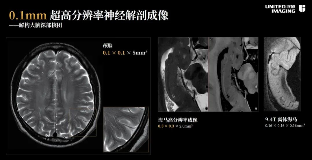 联影磁共振怎么样合作伙伴 ｜ 联影医疗科技股份有限公司新产品新技术_https://www.jmylbn.com_新闻资讯_第3张