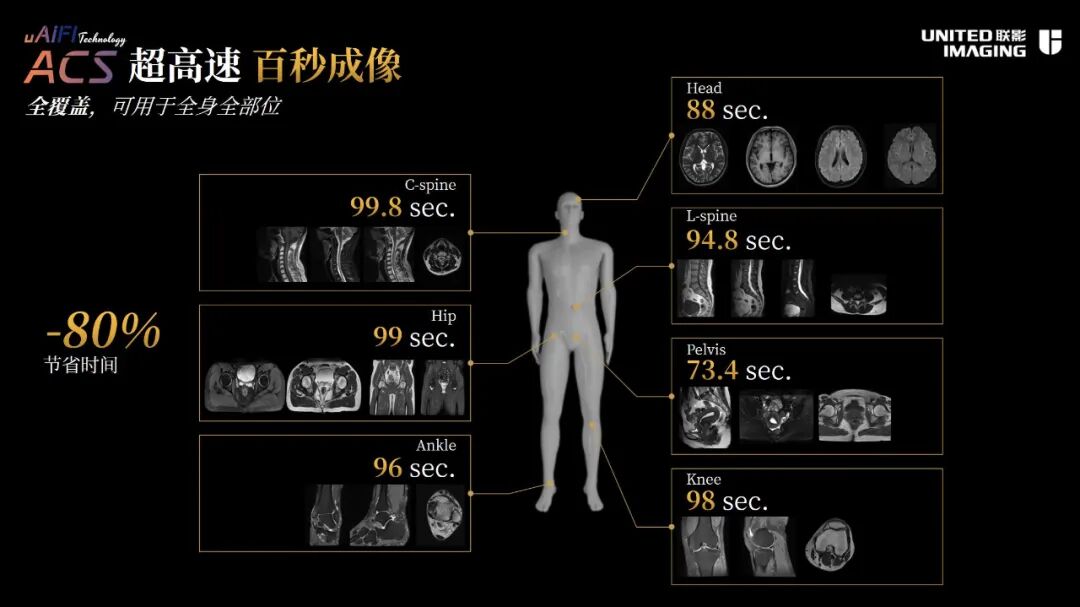 联影磁共振怎么样合作伙伴 ｜ 联影医疗科技股份有限公司新产品新技术_https://www.jmylbn.com_新闻资讯_第4张