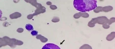 cover_image