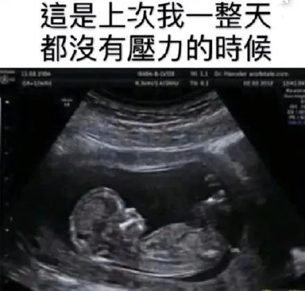 《打工人奇葩迟到理由大赏》，敢用最后一条的都是狠人！