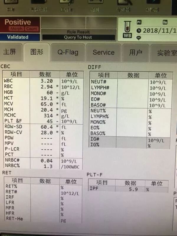 rbc直方图怎么看血常规散点图带给我们的深刻启示！_https://www.jmylbn.com_新闻资讯_第8张