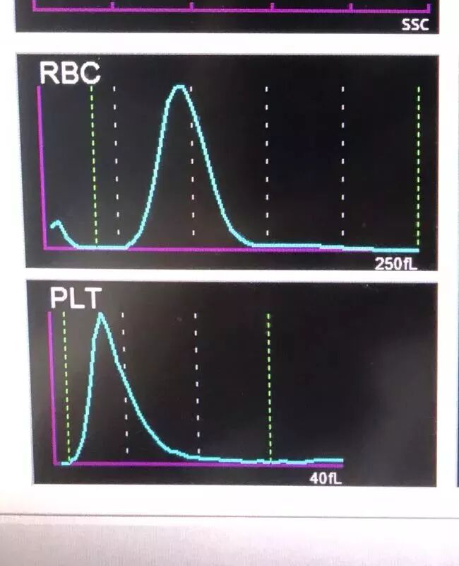rbc直方图怎么看血常规散点图带给我们的深刻启示！_https://www.jmylbn.com_新闻资讯_第4张