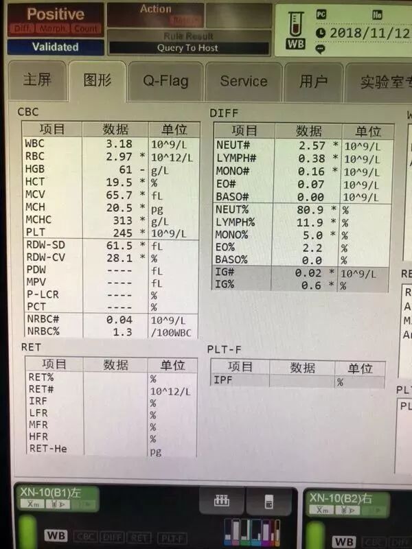 rbc直方图怎么看血常规散点图带给我们的深刻启示！_https://www.jmylbn.com_新闻资讯_第2张