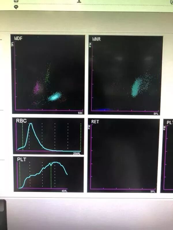rbc直方图怎么看血常规散点图带给我们的深刻启示！_https://www.jmylbn.com_新闻资讯_第5张
