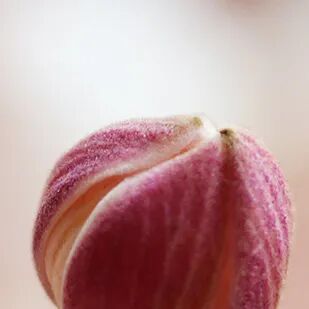 肋骨固定板怎么拆这样的脊柱内固定物，需要手术拆除_https://www.jmylbn.com_新闻资讯_第1张