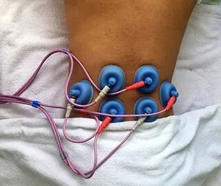 什么是中频干扰中频电疗神器——干扰电疗法_https://www.jmylbn.com_新闻资讯_第14张