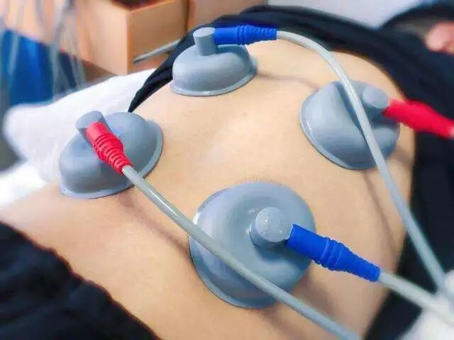 中频为什么能镇痛什么？中低频治疗会有如此多的治疗作用_https://www.jmylbn.com_新闻资讯_第4张