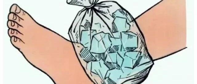 关于冰敷的争论：“良药”还是“毒剂”？