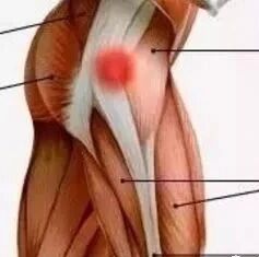 下肢、臀部疼痛的部位在腰腿痛中的诊断要点