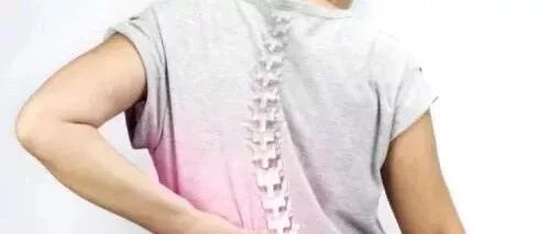 脊柱侧弯实用康复训练，动图详解！