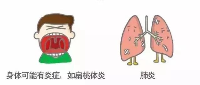 【收藏】史上最形象体检报告漫画解读！速速收藏！