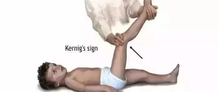 神经康复 | 康复科不得不掌握的神经系统体格检查