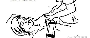 干货——关节松动术