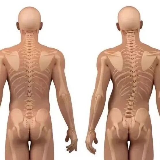 脊柱侧弯实用康复训练，动图详解！