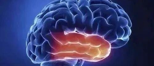 【卒中康复】脑出血诊疗6大要点汇总