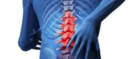 一上班就腰疼？“一站一坐”自测“腰突”还是“腰肌劳损” 附超实用缓解疼痛攻略