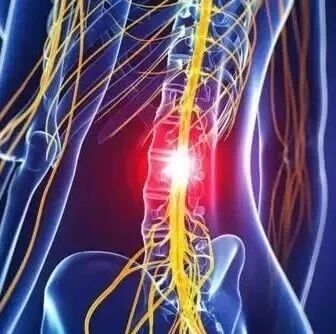 你的腰椎间盘突了吗？六个动作自测！附康复训练！