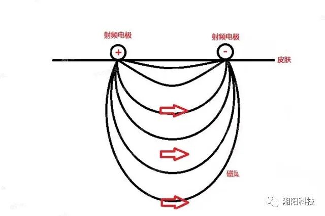 多极射频是什么射频美容原理及特点_https://www.jmylbn.com_新闻资讯_第4张