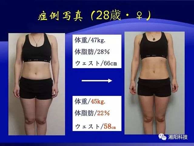 多极射频是什么射频美容原理及特点_https://www.jmylbn.com_新闻资讯_第8张