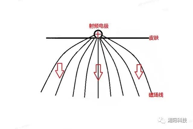多极射频是什么射频美容原理及特点_https://www.jmylbn.com_新闻资讯_第3张