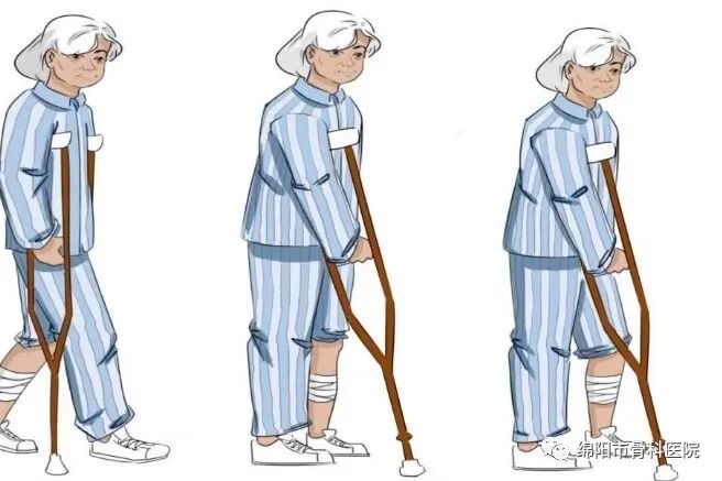 腋下拐杖什么牌子好下肢骨折患者该如何正确使用拐杖？_https://www.jmylbn.com_新闻资讯_第2张