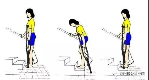 腋下拐杖什么牌子好下肢骨折患者该如何正确使用拐杖？_https://www.jmylbn.com_新闻资讯_第7张