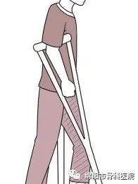 腋下拐杖什么牌子好下肢骨折患者该如何正确使用拐杖？_https://www.jmylbn.com_新闻资讯_第3张