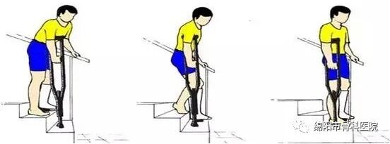 腋下拐杖什么牌子好下肢骨折患者该如何正确使用拐杖？_https://www.jmylbn.com_新闻资讯_第8张