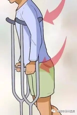 腋下拐杖什么牌子好下肢骨折患者该如何正确使用拐杖？_https://www.jmylbn.com_新闻资讯_第4张