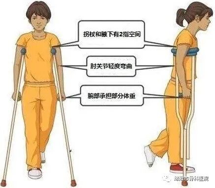 腋下拐杖什么牌子好下肢骨折患者该如何正确使用拐杖？_https://www.jmylbn.com_新闻资讯_第6张
