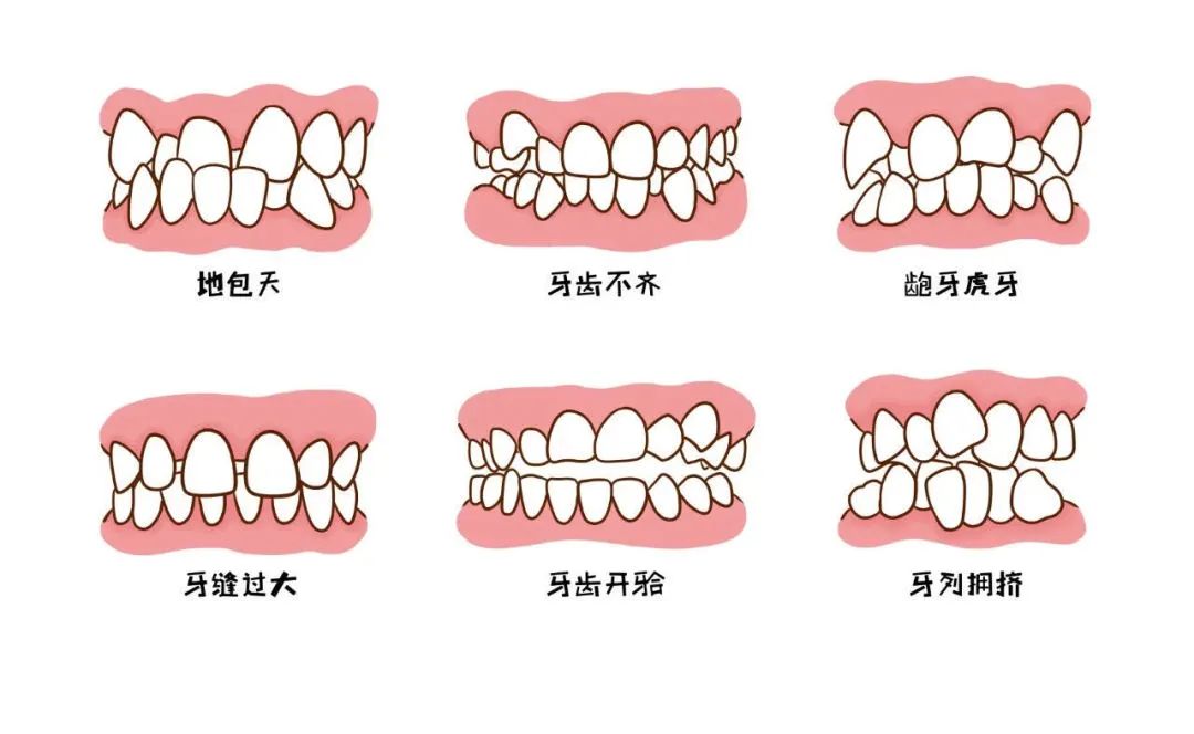 一起來聊聊這10個關於孩子的口腔問題|七巧板育兒堂 親子 第27張